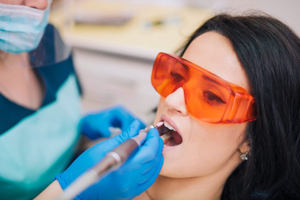 Dental Sealants