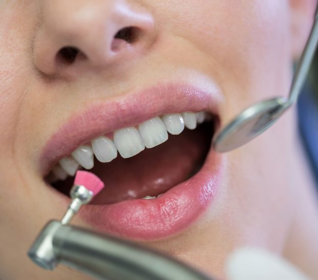 Teeth Cleaning